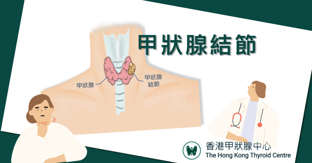 甲狀腺結節, 甲狀腺疾病, 甲狀腺治療