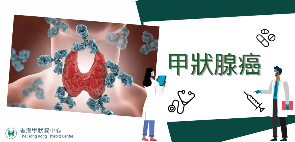 甲狀腺癌, 甲狀腺診斷, 大頸泡, 甲狀腺超聲波, 甲亢, 甲減